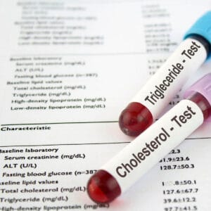 What does your Cholesterol level Mean Australia - Positive Nutrition