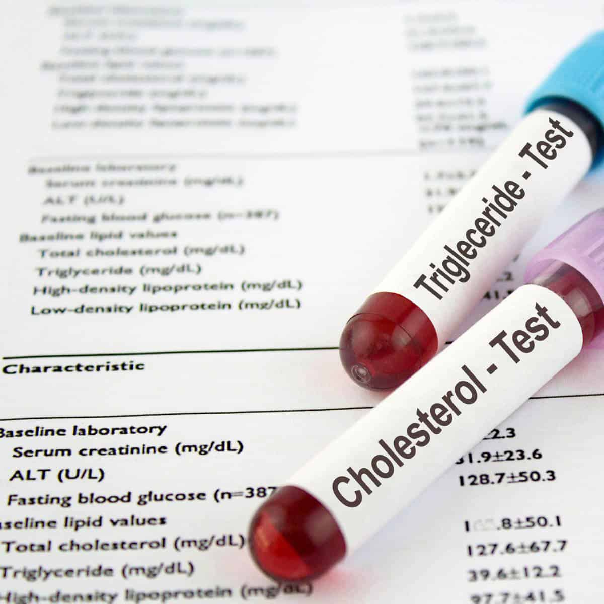 Cholesterol Levels showing on a report, test tubes with blood and cholesterol test typed on them.